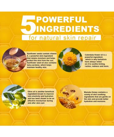 Manuka Honey Eczema Balm - Soothing Relief for Psoriasis Rashes Itchy Skin | 2 Fl Oz (Pack of 6) - Ideal for Kids & Adults - Buy Online on GoSupps.com