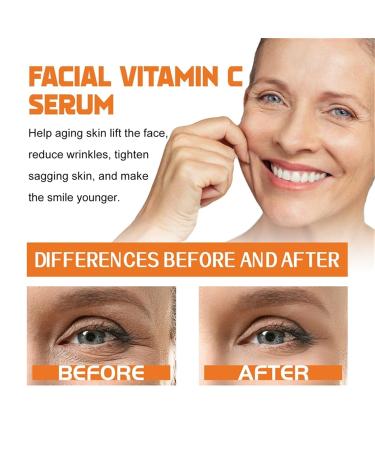 Super Vitamin C Serum for Face | Age-Defying Hydration with Niacinamide Hyaluronic Acid & Peptides | Reduces Wrinkles & Age Spots - 1pc - Buy Online on GoSupps.com