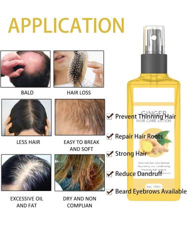Ginger Hair Care Lotion Hair Growth Spray Ginger Hair Growth Oil Anti Hair Loss Trengthen Hair Roots Hair Care Lotion for Men and Women Thicken and Strengthen for Hair Regrowth - Buy Online on GoSupps.com