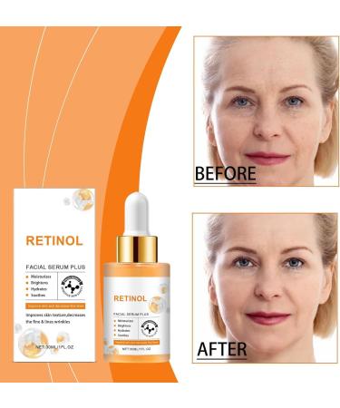  JIAOY Retinol Face Serum Retinol Anti-Aging Face Serum Retinol Anti-Wrinkle Face Serum Retinol Serum for Dull Skin Firming Moisturizing Brightening and Smoothing (6PCS) - Buy Online on GoSupps.com