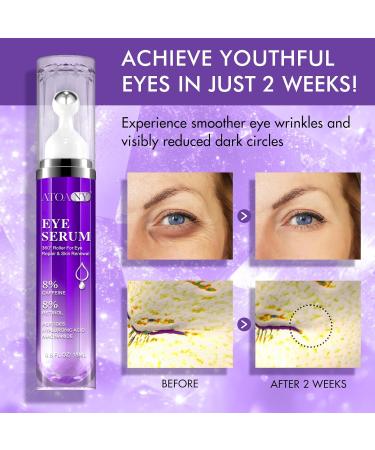 Eye Treatment Serum - 8% Caffeine & Retinol Hyaluronic Acid Niacinamide Peptides - Cream for Dark Circles Puffy Eyes Fine Lines - 360 Eye Roller Massage Ball Included 0.5 fl. oz - Buy Online on GoSupps.com