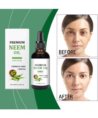 Neem Oil Skin Care Neem Oil for the Face | 100ml Cosmetic Neem Oil | Nourishing Oil for Hair Growth Natural Oil for Hair Repair - Buy Online on GoSupps.com