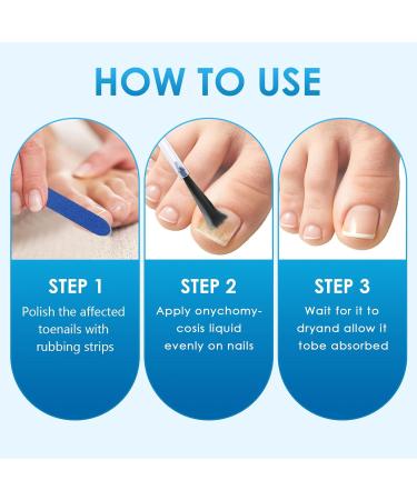 Yagaspantery 30 ml toenails caring nail repair protection and strengthening of brittle nails moisturizes dry nail skin for beautiful and wellgroomed nails nail growth and repair serum white - Buy Online on GoSupps.com