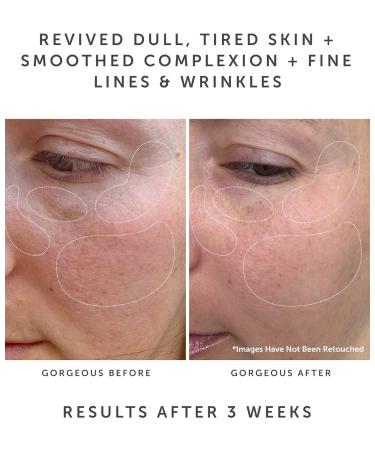 Buy ANCHOR Bio-Retinol Vitality Serum | Anti-Aging Skincare for Glowing Skin | International Shipping Available - Buy Online on GoSupps.com