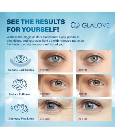 Under Eye Patches for Puffy Eyes - 60 Count Retinol & Collagen Gel Masks for Dark Circles Bags & Wrinkles - Anti-Aging Treatment for Men & Women - Buy Online on GoSupps.com
