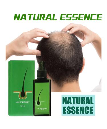 Organic Hair Growth Serum for Thinning Hair and Hair Loss - Nourishing Scalp Spray (120ml) - Buy Online on GoSupps.com