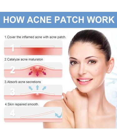 Acne Pimple Patches - Absorbing Cover with Tea Tree Oil Invisible Blemish Spot Hydrocolloid Skin Treatment Facial Stickers Five Sizes Blends in with skin - Buy Online on GoSupps.com