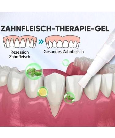 Dentiz Gums Therapy Gel & Tooth Whitening Set - 5PCs for Teeth Cleaning Stain Removal & Elevation | Shop Internationally! - Buy Online on GoSupps.com