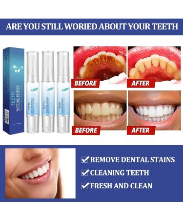 Gum Therapy Gel: 3pcs Teeth Whitening Pens for Gum Treatment - Buy Online on GoSupps.com