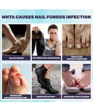 DIPDIPAN Toenail Fungus Repair Pens - Renew Discolored Foot & Toenails - 3 Pack - Buy Online on GoSupps.com