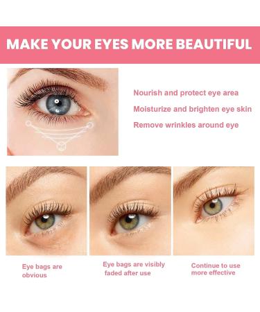 Rose Glow & Get It Cooling Eye Balm | Dark Circle Treatment | Hydrating & Brightening | On-the-go Solution - Buy Online on GoSupps.com