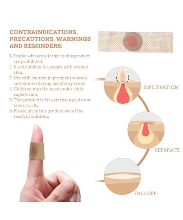 Healeved 100 pcs Removers Patches for Callus Cushioning | Hand & Foot Pad Cushions | Toe Care Protectors for Pain Relief | 7x2x0.8cmx2pcs Light Yellowx2pcs - Buy Online on GoSupps.com