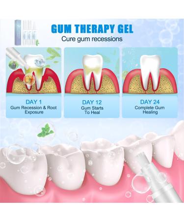 3 Pcs Neslemy Gum Shield Therapy Gel & Lovilds Gum Repair Treatment - Teeth Whitening Essence Pen - Optimal Oral Care Solutions - Buy Online on GoSupps.com