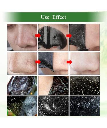 Blackhead Mask | Activated Charcoal Peel Off Face Mask for Deep Pore Cleansing | Sky-shop Acne & Blackhead Remover (120g - Buy Online on GoSupps.com