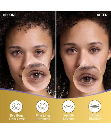 Under Eye Patches - 20 Pairs of Golden Eye Masks for Dark Circles Puffiness & Wrinkles | Cooling Eye Care with Hyaluronic Acid & Collagen - Skincare Treatment for Adults - Buy Online on GoSupps.com