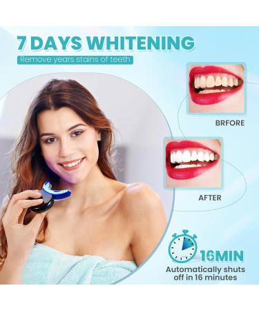 32 LED Tooth Whitening Kit - Safe Home Teeth Bleaching for Yellow & Smoke Stains Quick 15-Minute Treatment - Buy Online on GoSupps.com