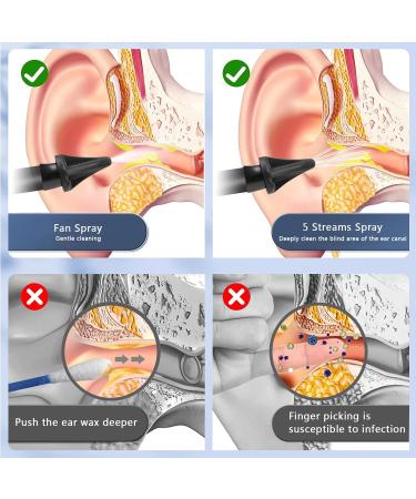 Water Powered Ear Cleaner - Electric Ear Wax Removal Kit with 4 Pressure Modes | Safe & Effective Ear Cleaning Washer System - Buy Online on GoSupps.com