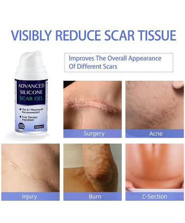 Advanced Silicone Scar Cream for Surgical Scars & Stretch Marks - 1oz - Buy Online on GoSupps.com