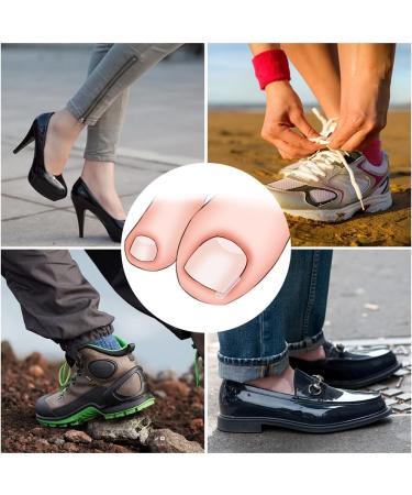 Corrective for Ingrown Nails Correction of Ingrown Nails Correction Kit 30 Pieces Correction Strips for Ingrown Nails Toe Nail Correction - Buy Online on GoSupps.com