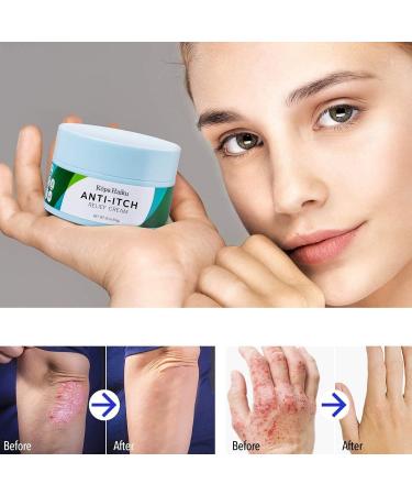 Kopa Haiku Antifungal Cream Anti-Itch Cream for Face & Body Athletes Foot Ringworm Eczema Jock Itch Maximum Strength - Natural Herbal Ingredients - Moisturizes & Nourishes - Buy Online on GoSupps.com