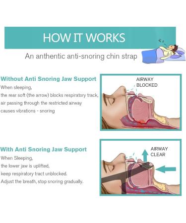 Lorcoo Stop Snore Device: The Perfect Solution for Snoring - Unisex Chin Strap for Men and Women - Buy Online on GoSupps.com