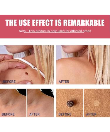 KOAHDE Rose Oil Soap Natural Extract Soap Gentle Safe Suitable for All Skin Types 80G - Buy Online on GoSupps.com