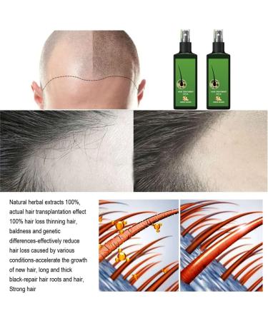 S rum De Croissance Des Cheveux Lotion Capillaire Hommes Et Femmes De Tous Types De Cheveux Aide La Croissance Des Cheveux Spray Au Gingembre Nourrissant. (2 pcs) - Buy Online on GoSupps.com