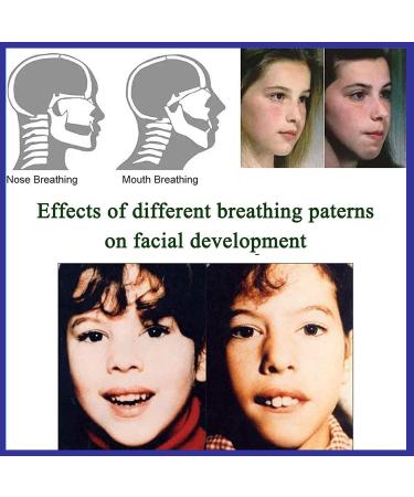 120PCS Mouth Tape Sleep Strips for Adults | Improve Nose Breathing, Reduce Snoring | Anti-Snore Adhesive Strips for Better Nighttime Sleep - Buy Online on GoSupps.com