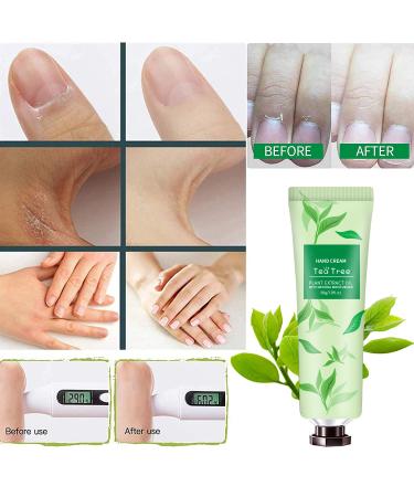 18 Pack Hand Cream Gift Set for Women - Deeply Moisturizing Lotion with Shea Butter & Vitamin E - Ideal for Dry, Cracked Hands - Mini Travel Size Moisturizer - Buy Online on GoSupps.com