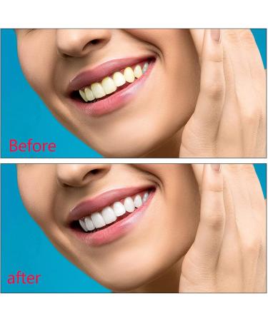 Perfect Smile Dentures Pebbles - Cosmetic Veneers & Temporary Prostheses for Men & Women | 6 Pairs of Reusable Tooth Whitener - Buy Online on GoSupps.com