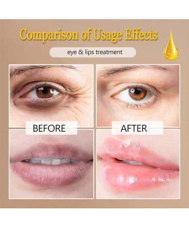 30 Pairs 24K Gold Eye & Lip Masks - Hydrating Crystal Collagen Patches for Puffiness Dark Circles & Fine Lines - Premium Skin Care - Buy Online on GoSupps.com