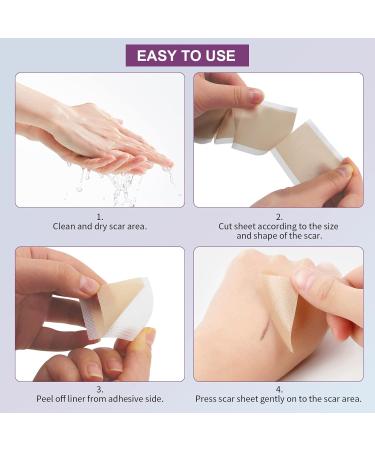 MQUPIN Silicone Scar Tape Roll (1.6 x 60 ) Silicone Scar Sheets Silicone Tape Reusable for C-Section Surgical Scar Keloid Acne Scar and Burn Scar - Buy Online on GoSupps.com