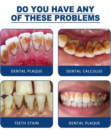 MOUMOUTEN Mouth Cleaning Spray - Oral Care Mouthwash for Fresh Breath & Tartar Removal 30 ml | International Shipping - Buy Online on GoSupps.com