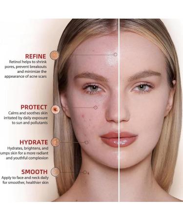 30mlLactic Acid 5% + Ha 2% Lactic Acid Pore Shrinking Essence Lactic Acid 5% Serum Lactic Acid Pore Minimizer Serum Facial Moisturizing Essence Collagen Serum with Hyaluronic Acid Face Serum for Women - Buy Online on GoSupps.com