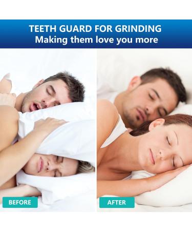 Mouth Guard for Teeth Grinding at Night - Comfortable Night Guards with 12 Cleaning Tablets - Buy Online on GoSupps.com