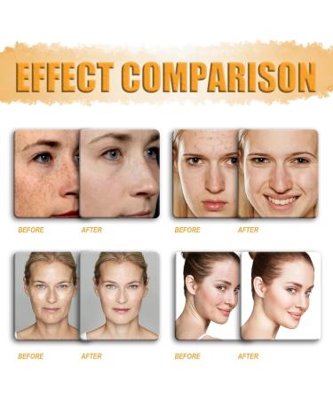 60 Pads Turmeric Kojic Acid Pads Turmeric Exfoliating Foaming Pads Turmeric Kojic Pads Turmeric Kojic Acid Cleansing Pads Face Pads Fades Dark Spots Face Cleansing Pads Exfoliating Face Pads - Buy Online on GoSupps.com