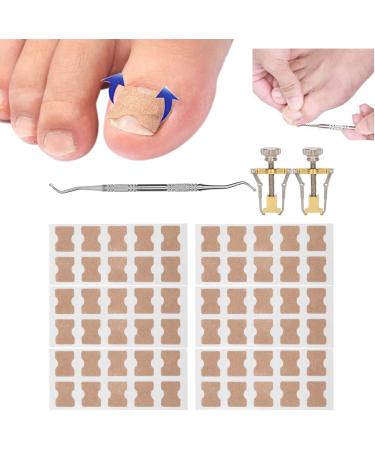 9Pcs Ingrown Toenail Corrector Strips Ingrown Toenail Treatment Strips Brace Foot Care Tool Kit Paronychia Toe Nail Fixer Pedicure Tool Nail Toenail Corrector Sticker Nail - Buy Online on GoSupps.com