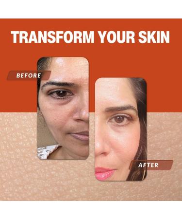 MegFresh Renewal Cleanser | Berry Exfoliating Gel | Natural Scent | 4 fl. oz. | Buy Internationally - Buy Online on GoSupps.com