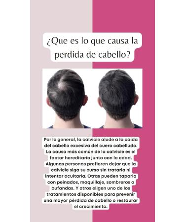 G Beauty Hair Strength Shampoo - Hydrating & Strengthening for All Hair Types | Best for Hair Loss & Post Hair Transplant - Buy Online on GoSupps.com