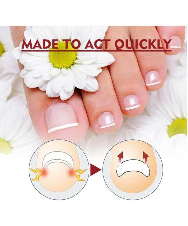 (100% Effective) KYOSK 10ml German Anti Paronychia Relief Oil Anti Paronychia Relief Oil Treatment Repair Paronychia Improve Toenail Health (3pcs) - Buy Online on GoSupps.com