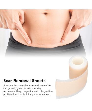 Scar Removal Tape Roll - Self Adhesive, Waterproof & Reusable for Postpartum Recovery | Restores Elasticity - Buy Online on GoSupps.com