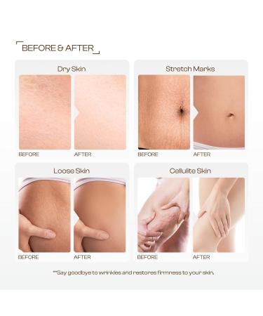 Jtopyrt Hibiscus Honey Firming Cream: Organic Skin Tightening Moisturizer for Women Anti-Aging Wrinkle Reduction - Buy Online on GoSupps.com