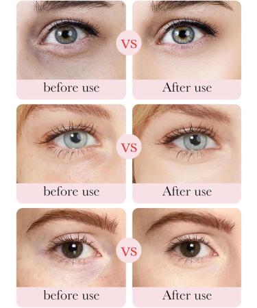 Rose Under Eye Mask Rose Under Eye Patches Rose Eye Patches for Dark Circles and Puffy Eyes Hydrating Moisturising Reduce Fine Lines Anti-Ageing Collagen Under Eye Patches - Buy Online on GoSupps.com