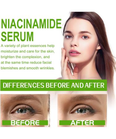 Nmbol Cream Instant Anti-wrinkle WL 1 - Buy Online on GoSupps.com