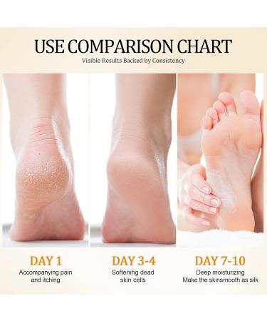 Geruicee 2 Pieces Urea Foot Cream Stick for Dry & Cracked Skin Intensive Repair Care for Heels Hands and Elbows Fast Absorbing Moisturizing Cream against Calluses 40 g x 2 - Buy Online on GoSupps.com