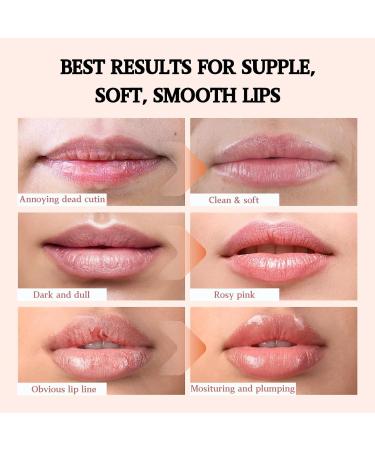 Lip Balm Propolis Lip Scrub Gel Lip Scrub Exfoliator Lip Lightening For Dark Lips & Women And Men Beeswax For Skin Hydrating Lip Balm For Dry & Chapped & Peeling & Cracked Lips Lip Moisturizer - Buy Online on GoSupps.com