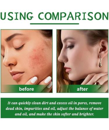 Pepper Ointment For Tanning Active Pepper Ointment 100 Ml Ointment Rich In coll-agen And Argan Oil Firming & Modeling Premium Quality Skin Care Products For Women And Men - Buy Online on GoSupps.com