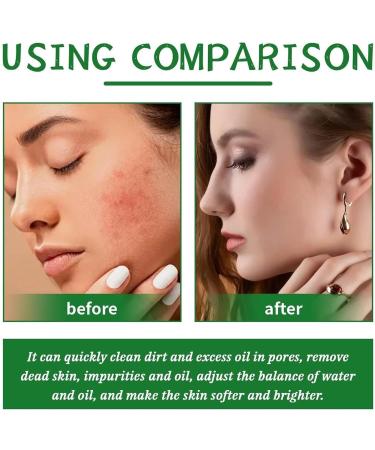 Premium Pepper Ointment Plus with Argan Oil | Active Browning Solution for Men & Women | 100g - Buy Online on GoSupps.com