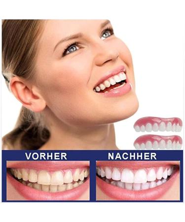 YC Replacement Veneers for False Teeth - Top & Bottom Cosmetic Makeover Set | 3 Pairs for White Beautiful Dentures - Buy Online on GoSupps.com