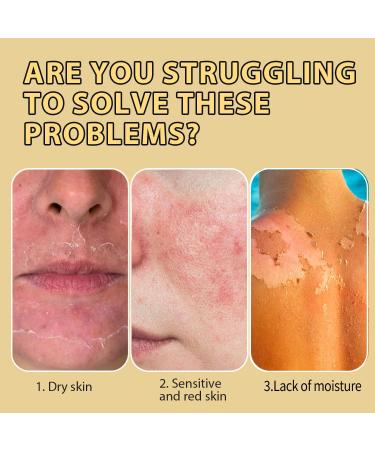 Beef Tallow for Skin - Beef Tallow For Face - Tallow Face Moisturizer - Hydrating Tallow Balm with Raw Honey and Beeswax - Grass Fed Beef Tallow For Skin -Moisturizer for Face Body&Sensitive Skin White - Buy Online on GoSupps.com